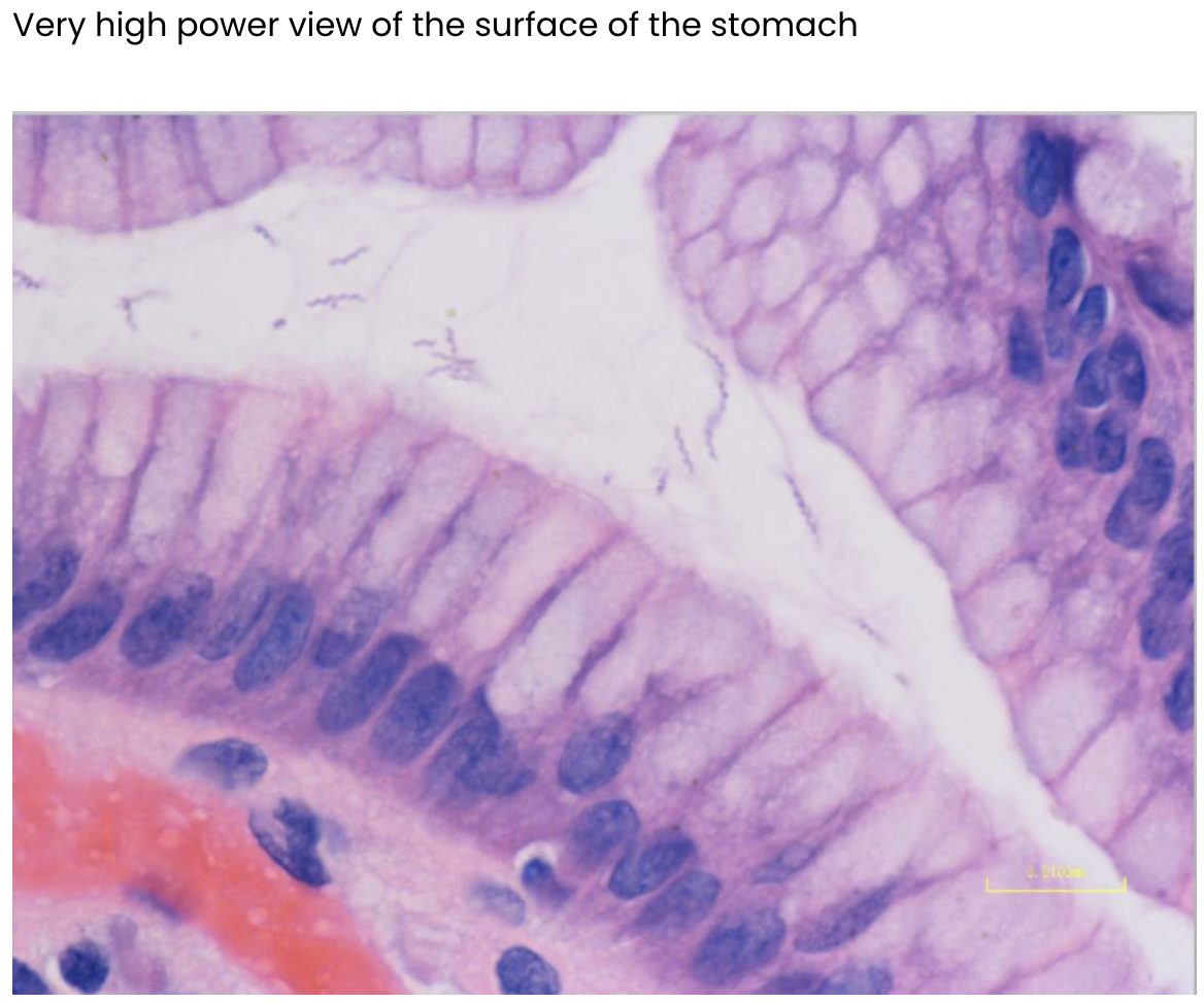 <p>Appears to be some microorganism- bacteria in lumen </p><p>Possible infiltration of lymphocytes into gastric cells</p>
