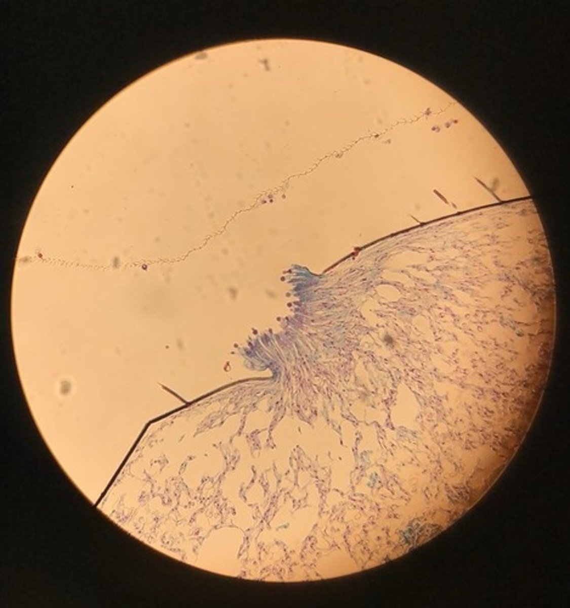 <p>Flugmögel, hyfer, konidioforer och konidiespore (zygomyceter)</p>