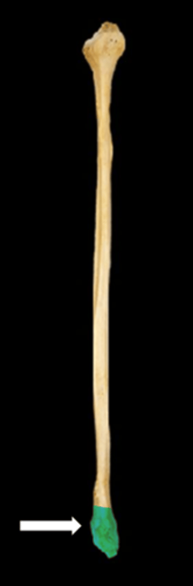 <p>name the part</p>