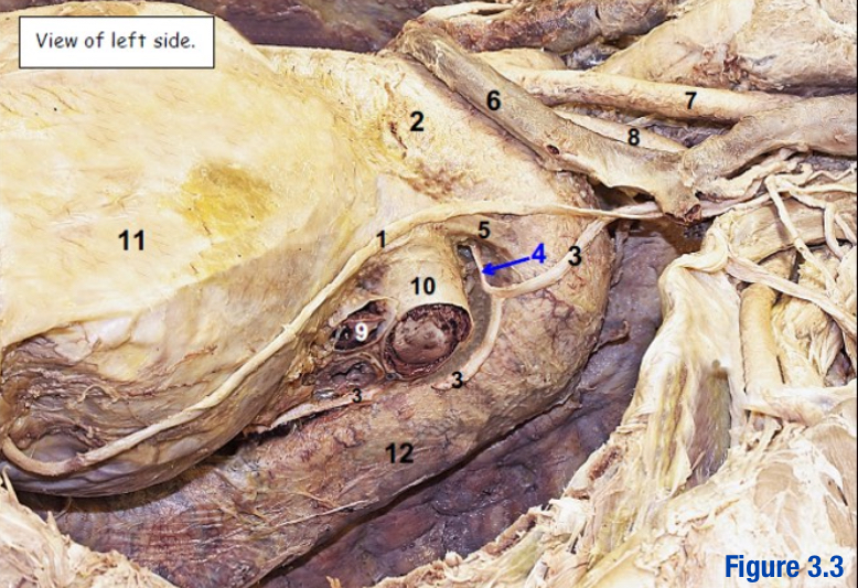 <p>Adult remnant of the ductus arteriosus (shunt during fetal circulation) - Include number in diagram</p>