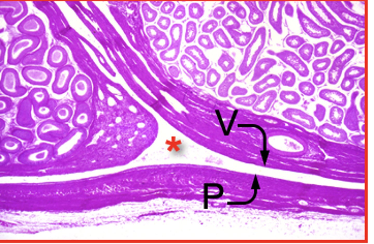 <p>These two layers (visceral and parietal) are parts of which layer?</p>