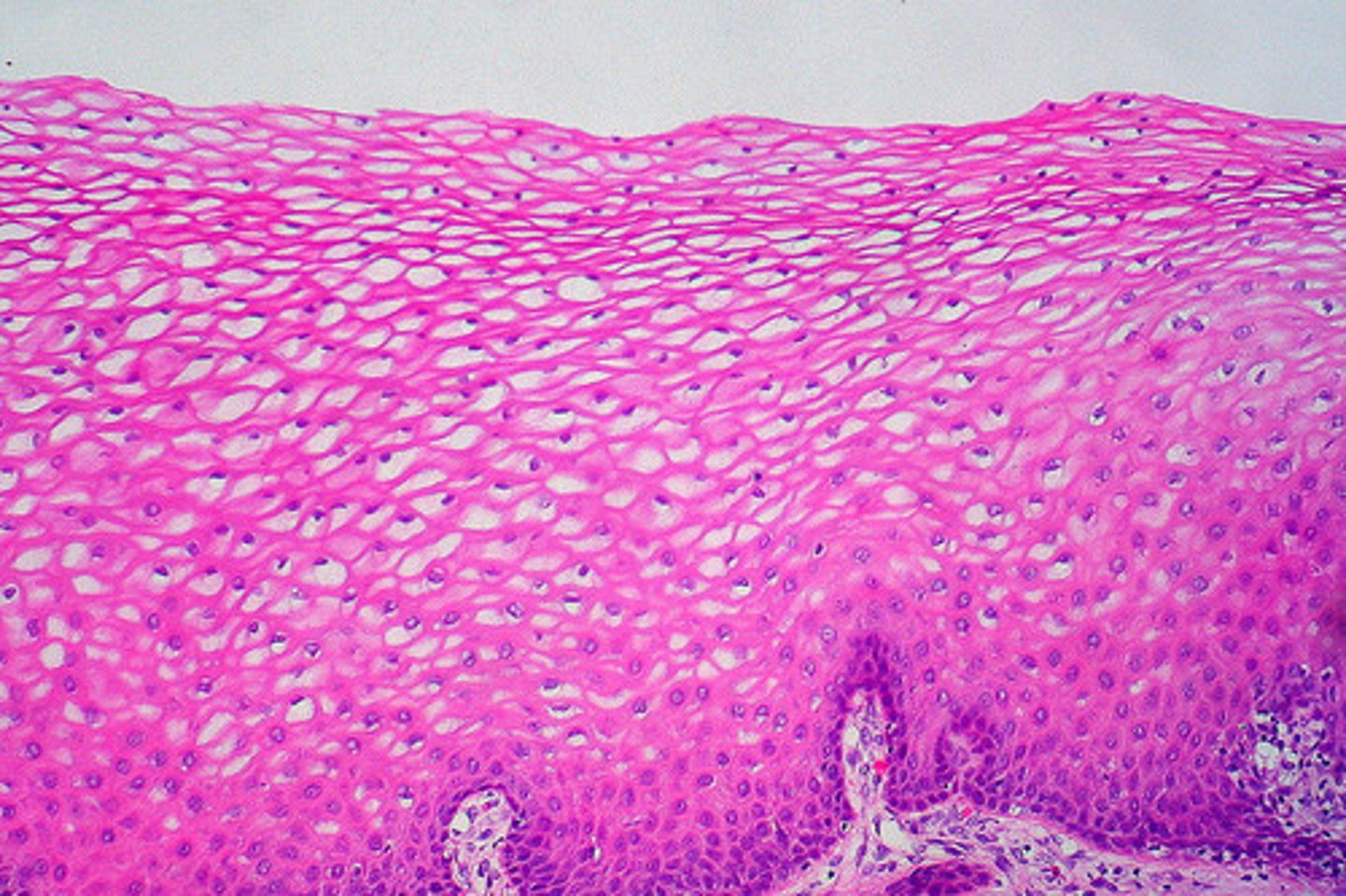 <p>nonkeratinized type forms the moist linings of the esophagus, mouth, and vagina; keratinized variety forms the epidermis of the skin, a dry membrane</p>