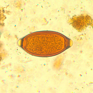 <p>in human stool</p><p>cecal mucosa inflammation, catarrhal enteritis, rectal prolapse, growth retardation, bloody/mucoid diarrhea</p><p>worldwide (common in tropics)</p>