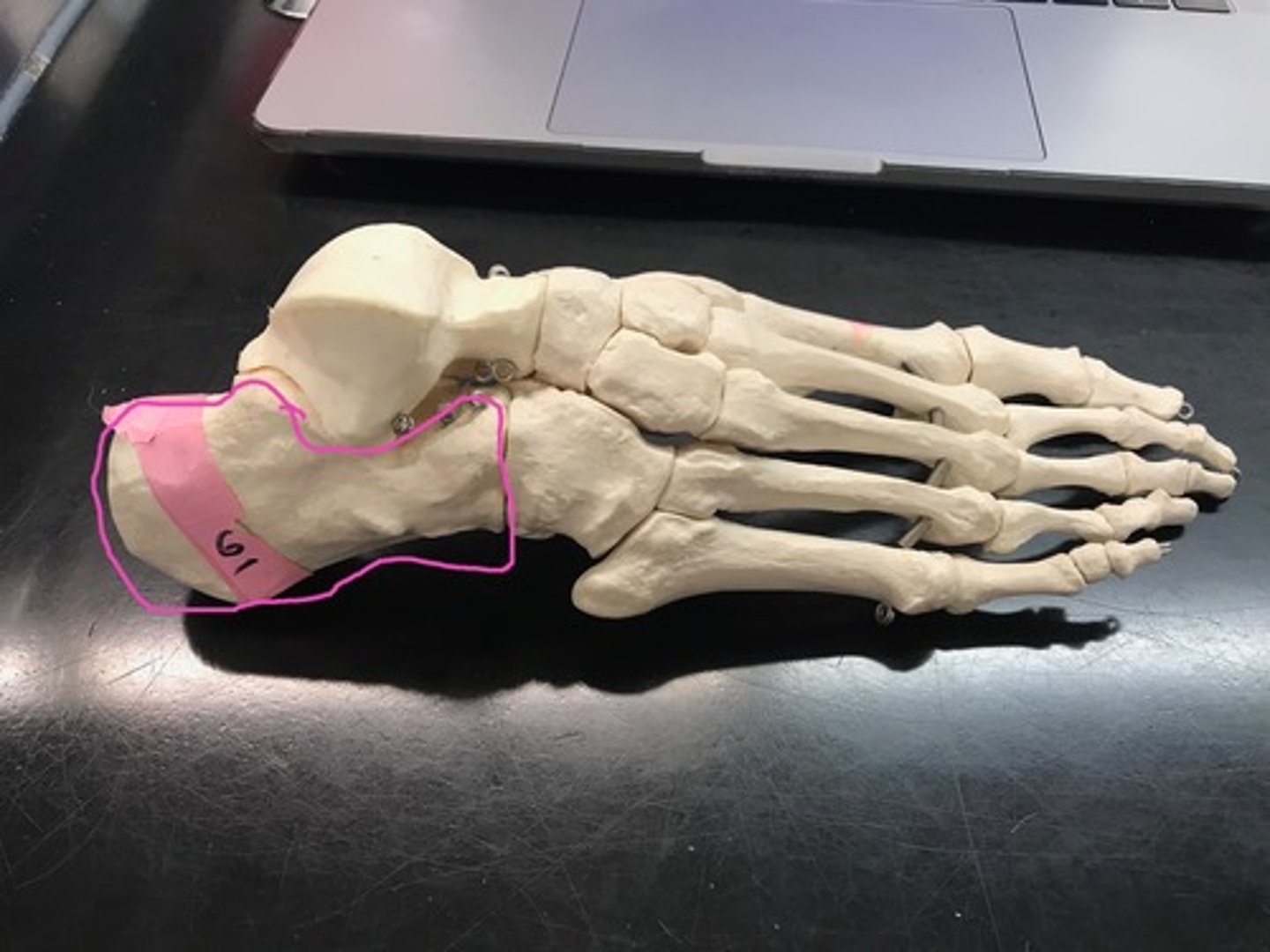 <p>calcaneus of the tarsal</p>