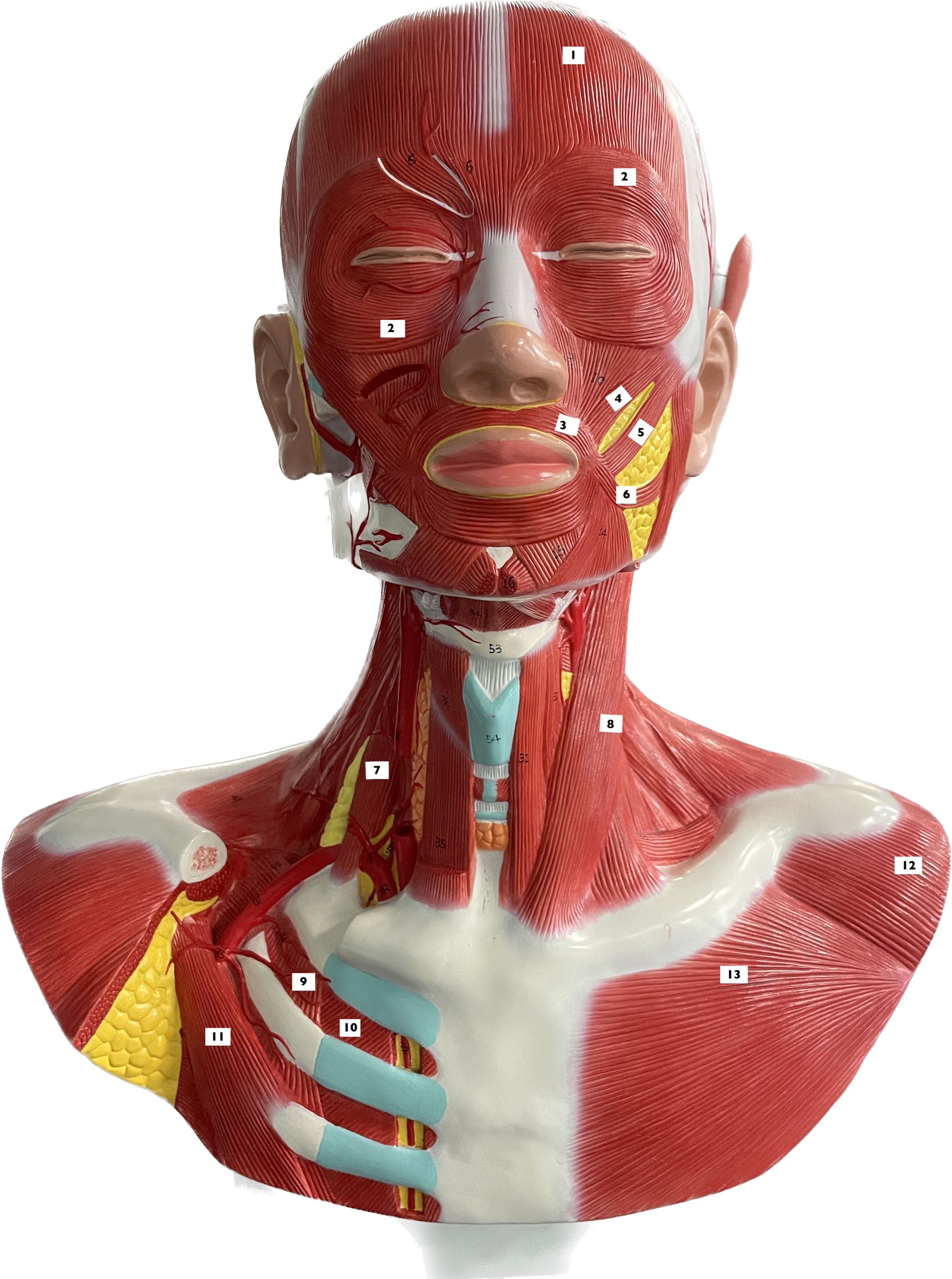 deltoid - abducts humerus