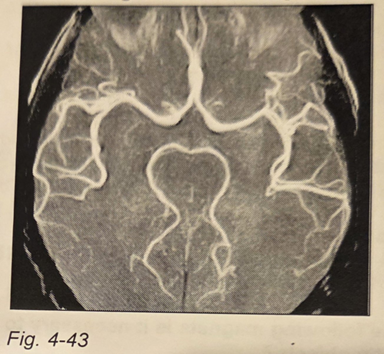 <p>gradient echo</p><p>3 multiple choice options</p>