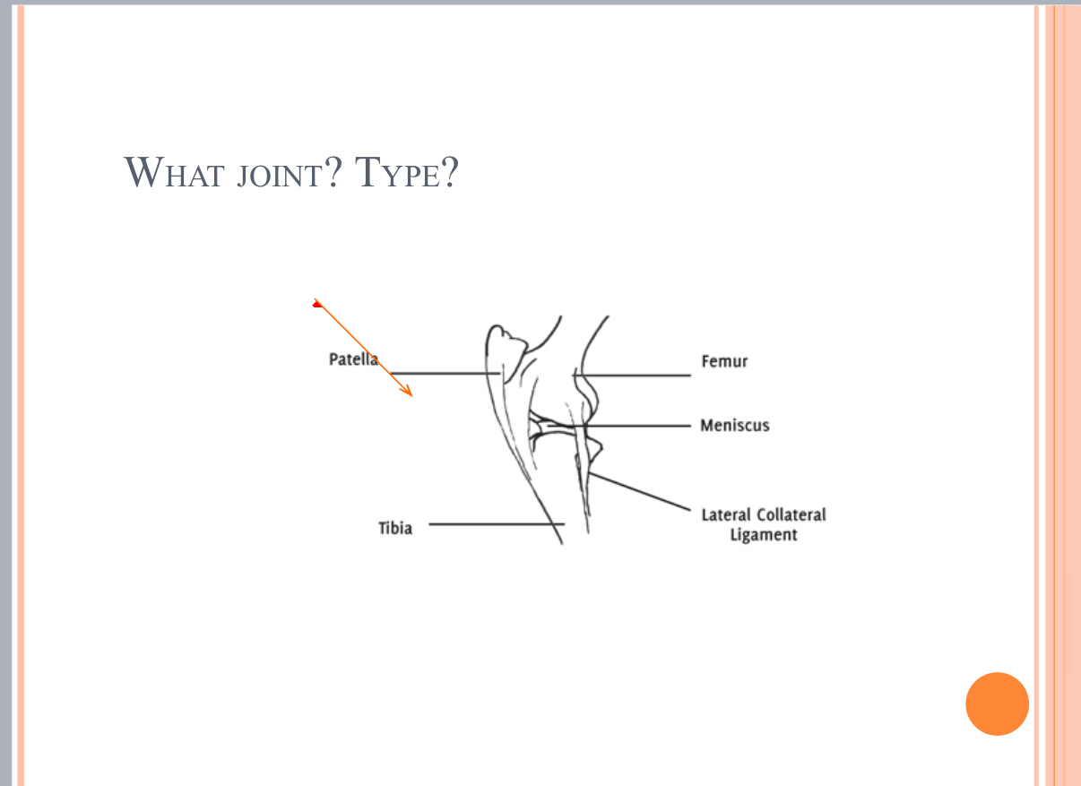<p>What Type of Joint?</p>