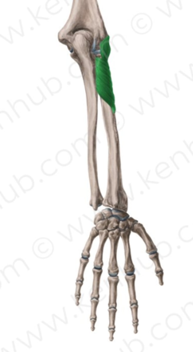 <p>Welke spier is dit?</p>