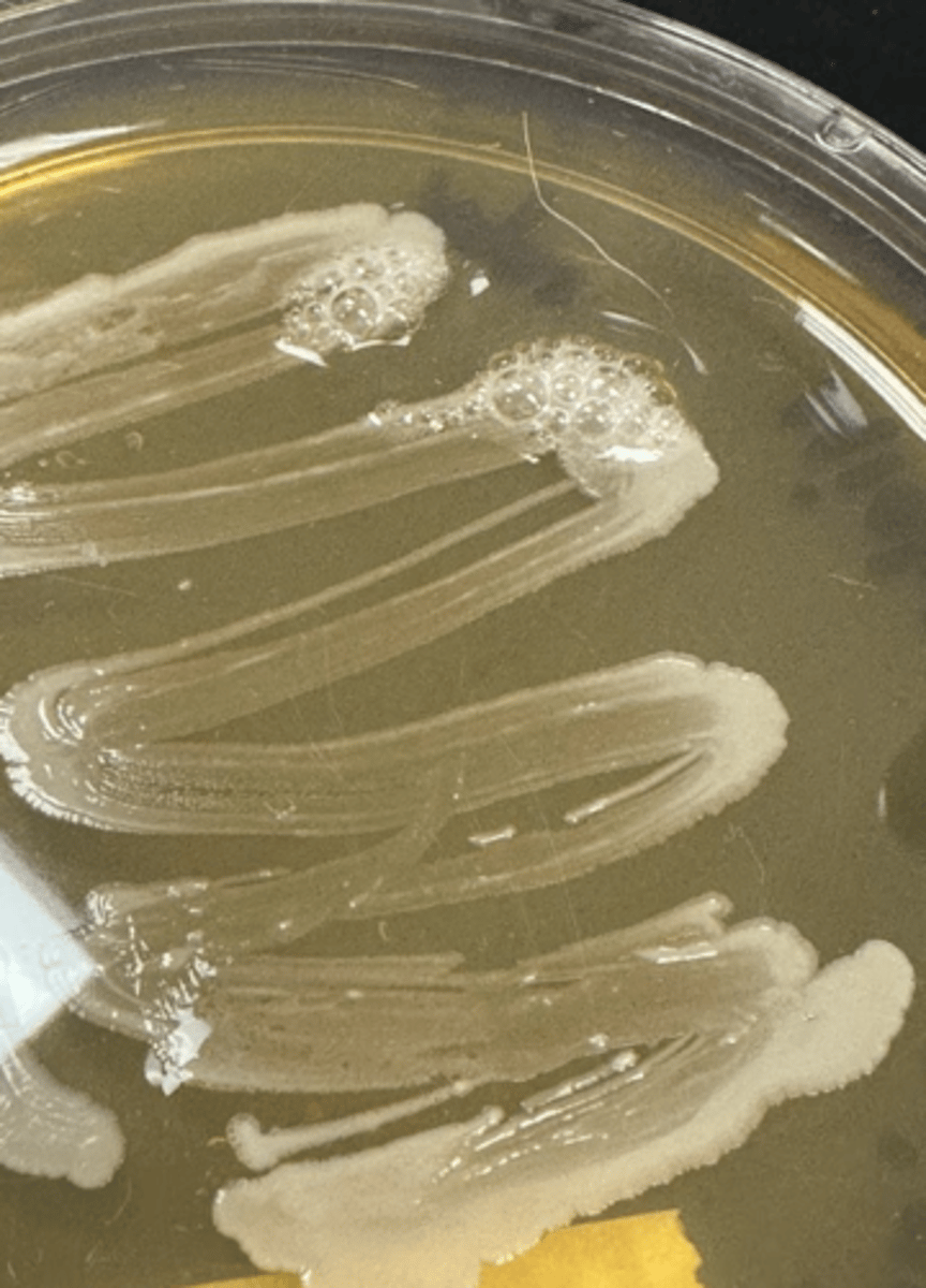 <p>What is a positive and negative reaction for the Catalase Test</p>
