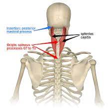 <p>Post neck</p><p>O: lig nuchae, SP C3-T3</p><p>I: mastoid process, lat sup nuchal line occipital.</p><p>A: Bilat ext head and neck, unilat flex, ipsi lat rot</p>