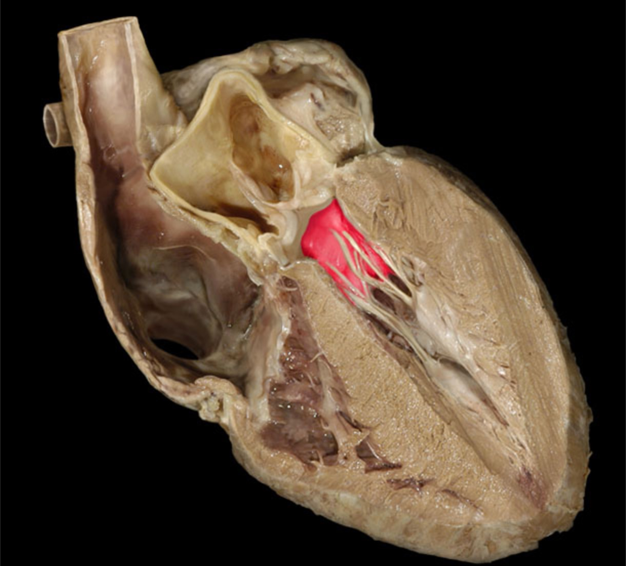 knowt flashcard image