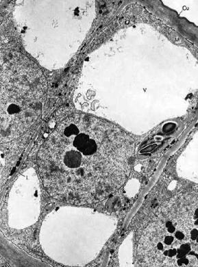 <p>What organelle is the large white space?</p>