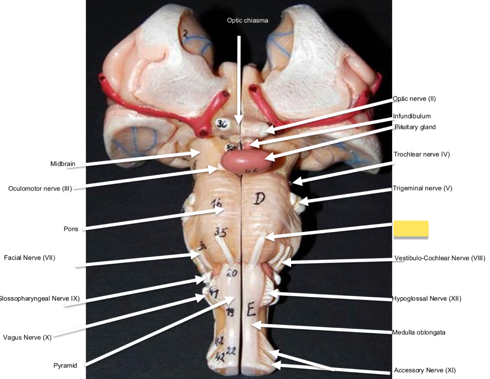 <p>Name this cranial nerve&nbsp;</p>