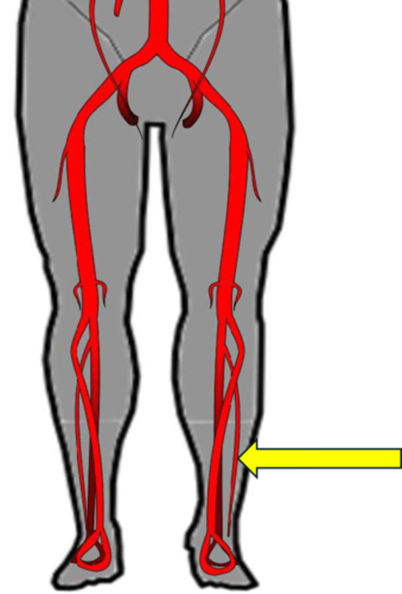 <p>Name the red vessel.</p>
