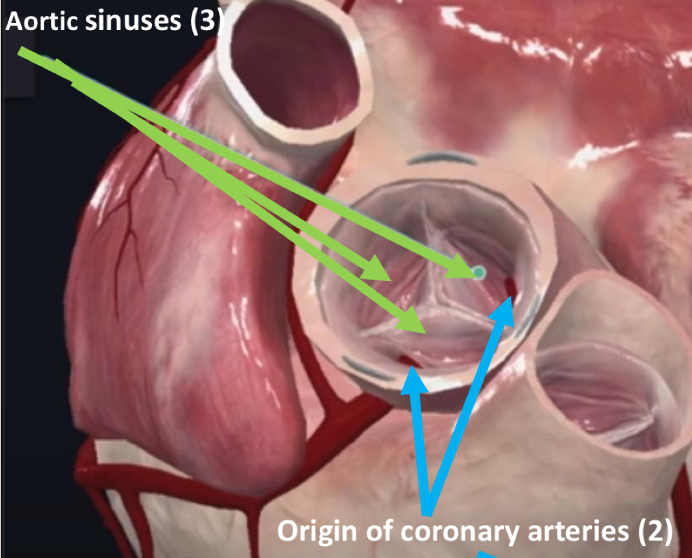 <p>Aortic valve</p>