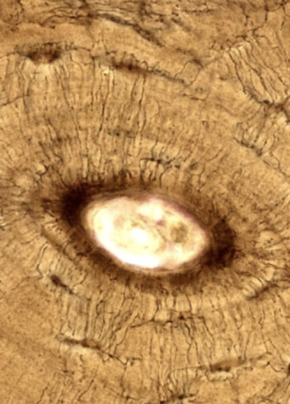 <p>Supportive connective tissue with calcified extracellular matrix. Its functions include support, movement, protection, production of blood cells, storage of ions, and endocrine regulation.</p>