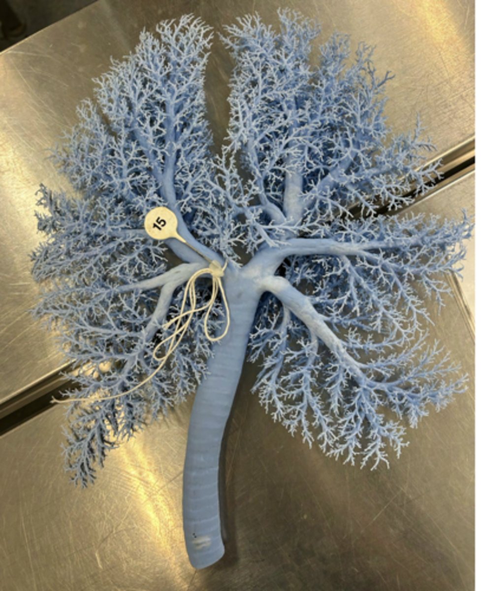 <p>Upon inspiration, what is the next structure air flows through?</p>