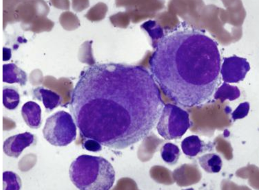 <p>is this an early or late megakaryocyte?</p>