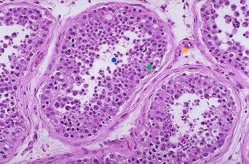 <p>what is the blue dot pointing to?</p>