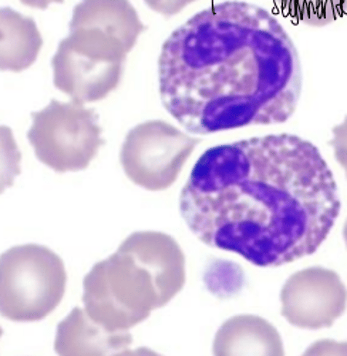 <p>what leukocyte is this?</p>