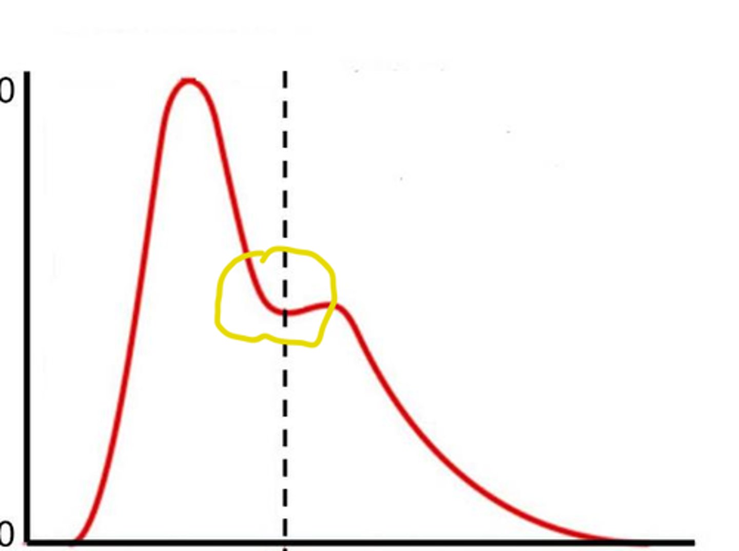 <p>"shock wave" from forceful closure of semilunar valves on the arterial pressure waveform</p>
