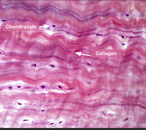 <p>Vertebral discs, pelvic cartilage </p>