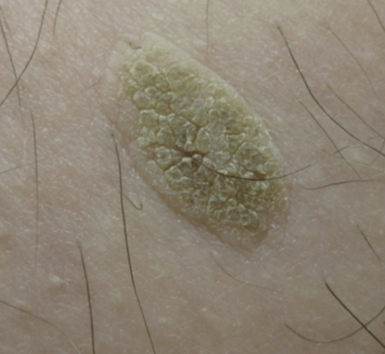 <p>What is shown in the following image?</p>