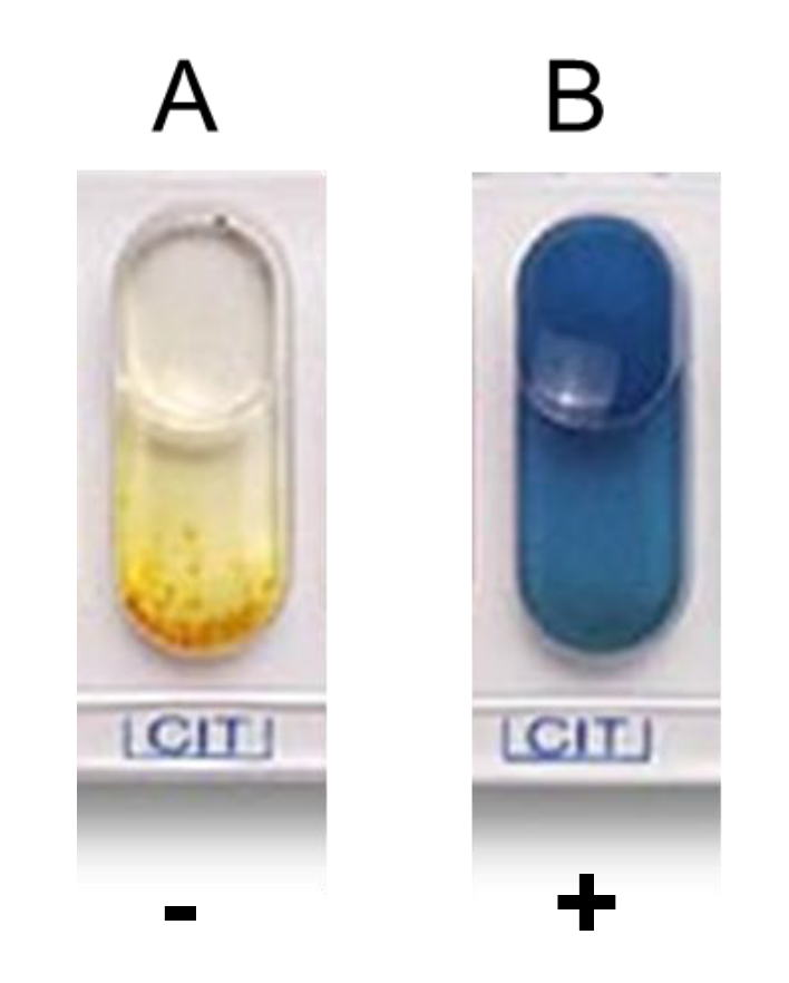 <p>Citrate Test (CIT)</p><p>To determine whether bacteria can utilize citrate as a sole carbon source by producing citrase.</p>