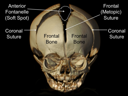 crowning or frontal body cut
