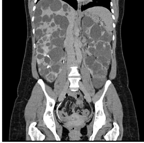 <p>What is this and what type of scan </p>