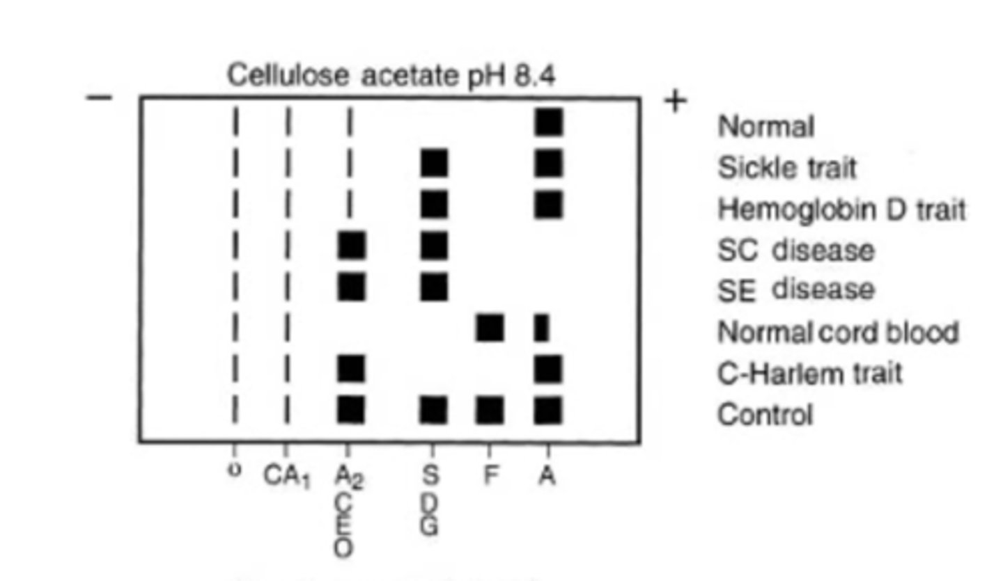 <p>Hb S migrates with Hb D and Hb G</p>