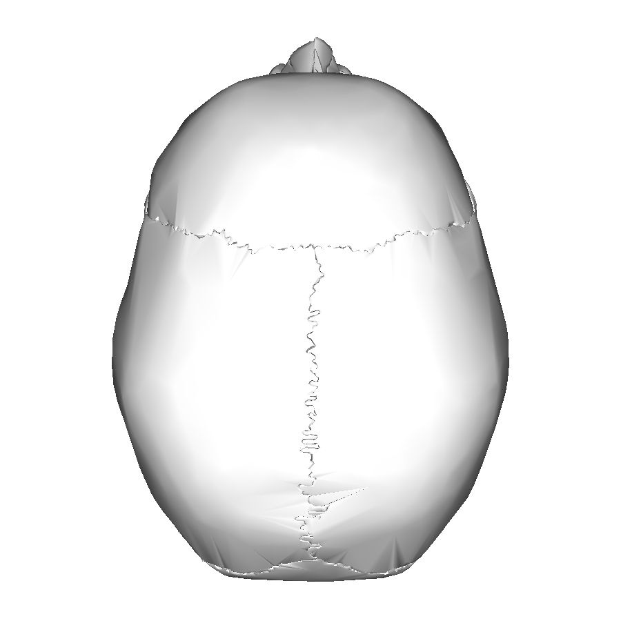 <p>Sagittal Suture</p>