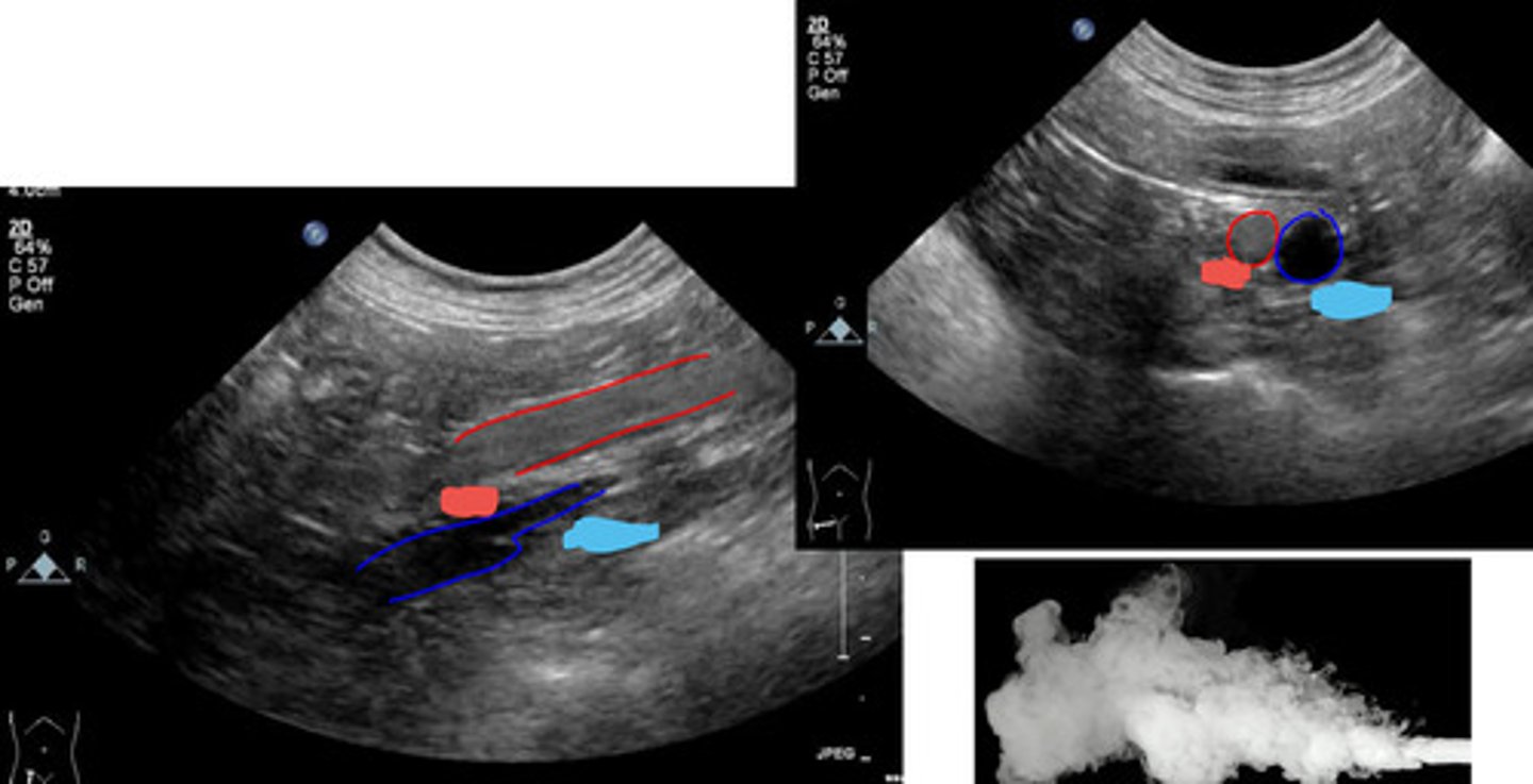 <p>what is the red and blue vasculature?</p>