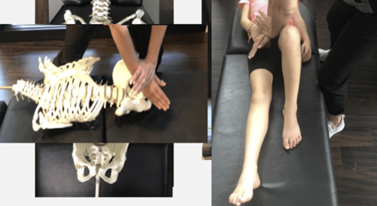 <p>PP: Supine-uninvolved knee &amp; hip flexed with foot flat on table</p><p>DP: Modified fencer/square stance on uninvolved side facing caudal</p><p>CH: Hypothenar contact of cephalad (R) hand on anterior aspect of the involved pubis (barrier over pubis)</p><p>IH: Caudal (L) hand reinforces CH or establishes a palmar contact over the involved distal thigh</p><p>LOD: A-P</p>