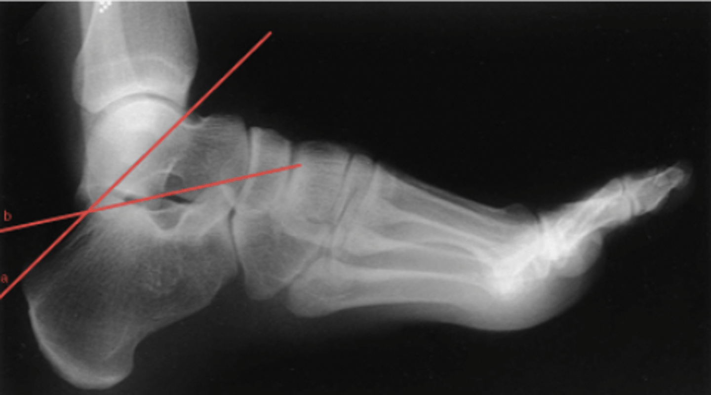 <p>What structure is highlighted?</p>