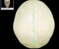<p>between the two parietal bones</p>