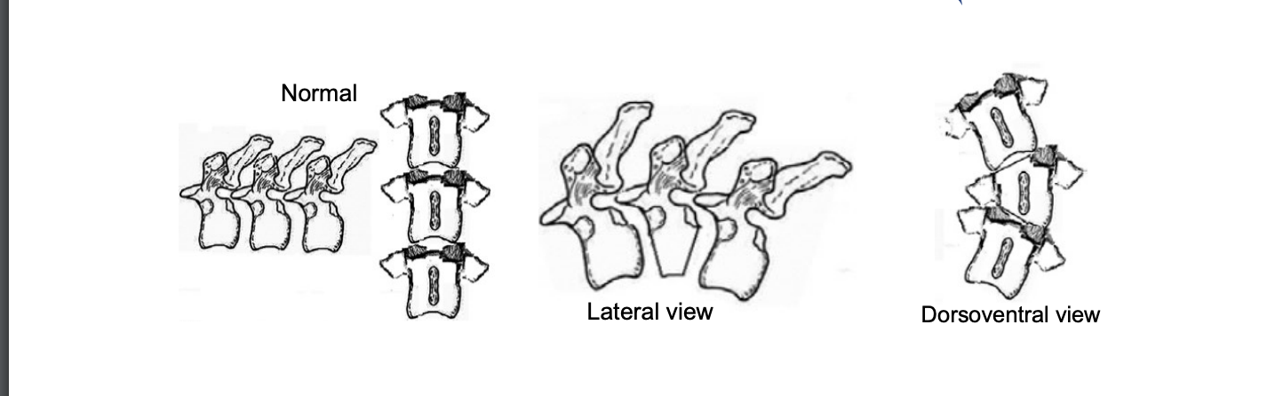 <p>pathgenesis: o Failure of vertebrae to form properly, usually vertebral body o Typically wedge shaped o Vertebral column instability and spinal cord compression</p>