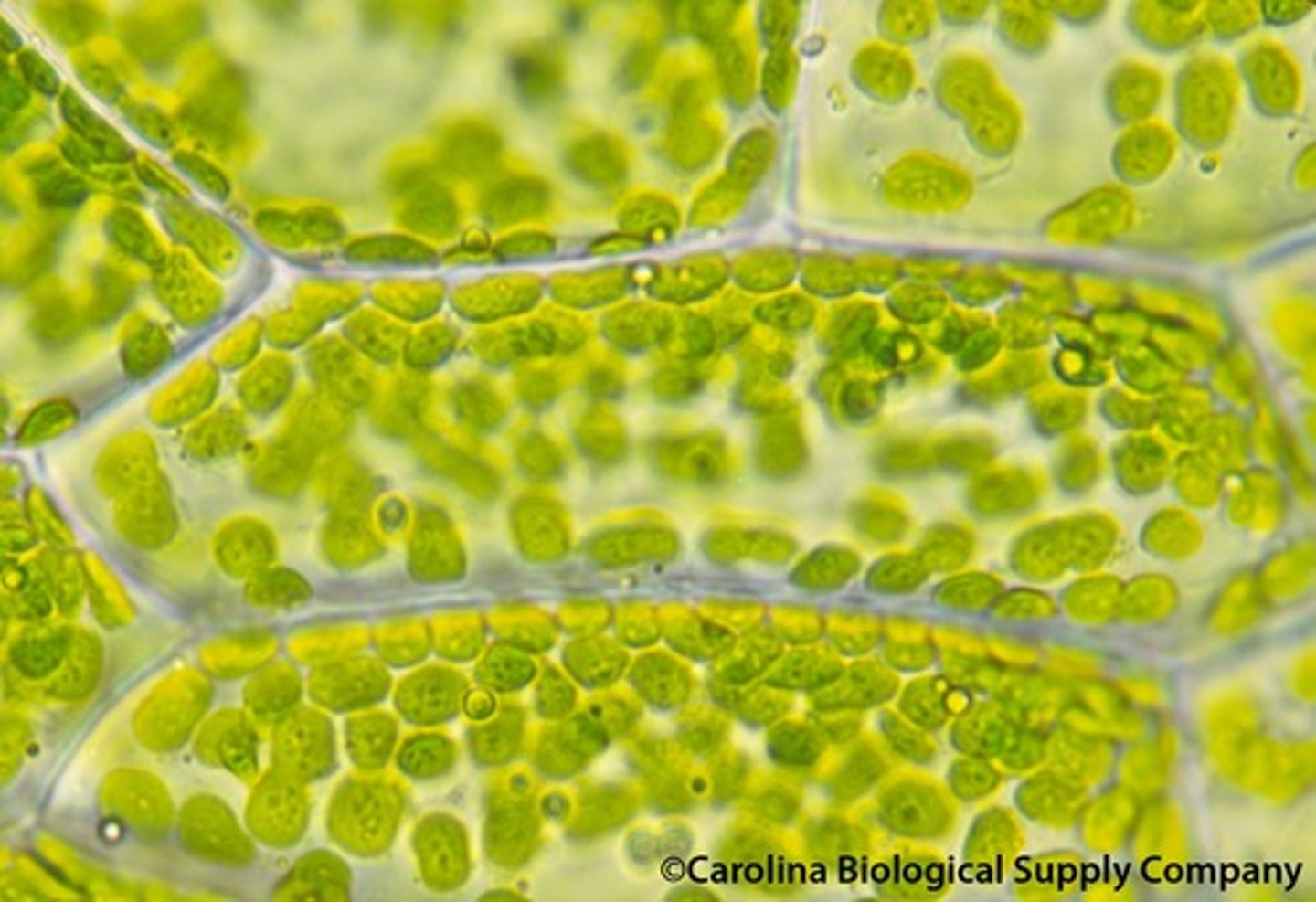 <p>An organelle found in plant and algae cells where photosynthesis occurs</p>