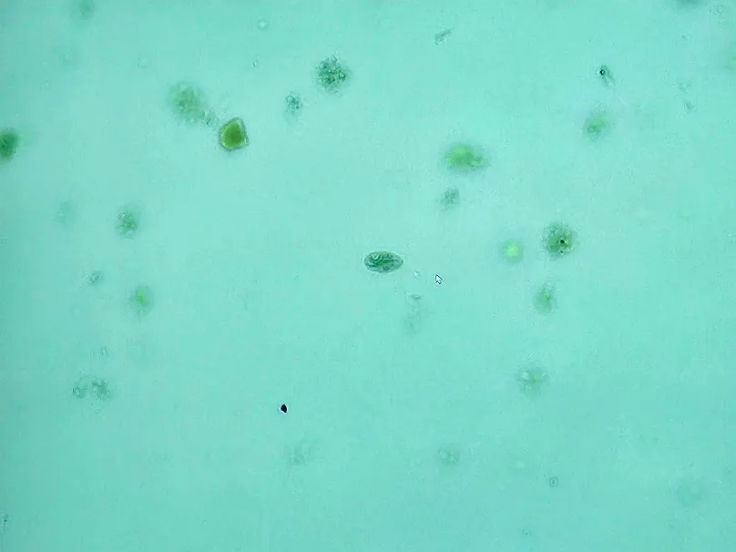 <p><span data-name="microscope" data-type="emoji">🔬</span><span data-name="petri_dish" data-type="emoji">🧫</span><strong><span> </span>Na podstawie zdjęcia preparatu:</strong></p><p></p><ul><li><p><span data-name="book" data-type="emoji">📖</span><span> </span>rozpoznaj gatunek pasożyta;</p></li></ul><p></p><ul><li><p><span data-name="recycle" data-type="emoji">♻</span><span> </span>rozpoznaj wszystkie formy rozwojowe;</p></li></ul><p></p><ul><li><p><span data-name="microbe" data-type="emoji">🦠</span><span> </span>wskaż organelle i cechy charakterystyczne dla danego gatunku;</p></li></ul><p></p><ul><li><p><span data-name="mask" data-type="emoji">😷</span><span> </span>nazwij chorobę, którą pasożyt wywołuje.</p></li></ul><p></p>