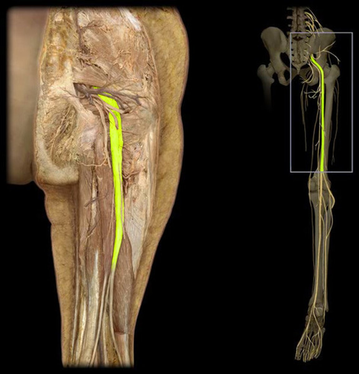 <p>nerve extending from the base of the spine down the thigh, lower leg, and foot</p>