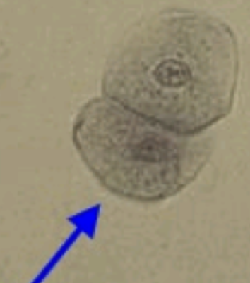 <ol start="45">
<li>What does a renal epithelial cell look like?</li>
</ol>