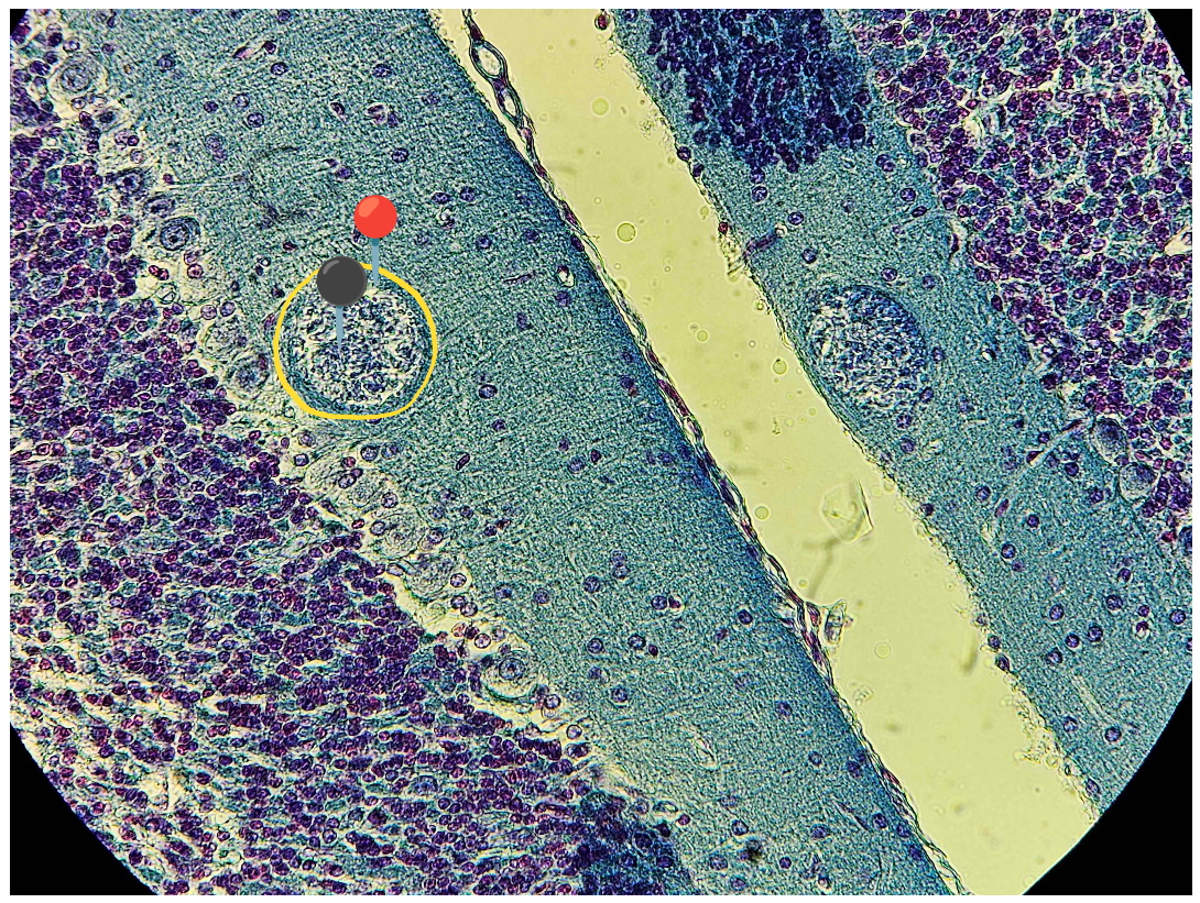 <p><strong><em>Toxoplasma gondii</em></strong></p><p>(Cysta)</p><p></p><p><strong>Organelle:</strong></p><p></p><ul><li><p><span>🔴</span> - otoczka;</p></li></ul><p></p><ul><li><p><span>⚫️ - bradyzoity.</span></p></li></ul><p></p><p></p><p><strong>Parazytoza:</strong> <em>Toksoplazmoza</em></p><p></p>