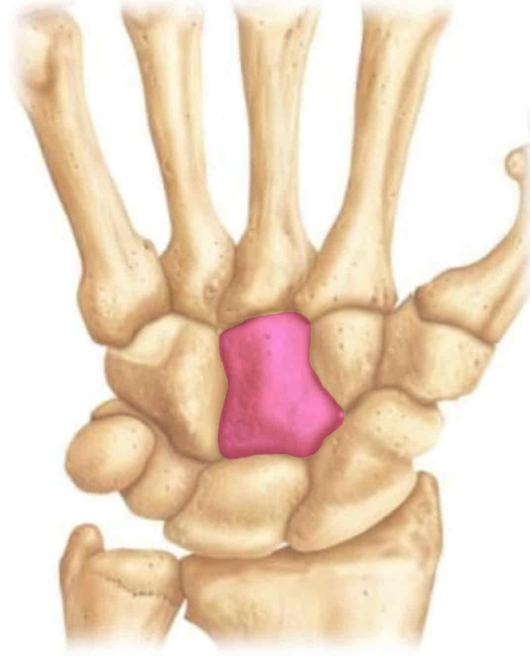 term image