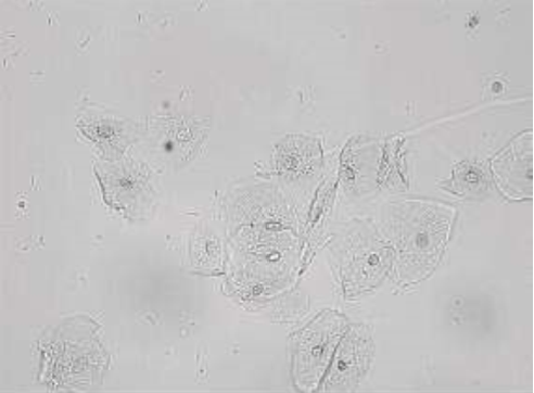 <p>These cells are present on sediment evaluation. What are they?</p>