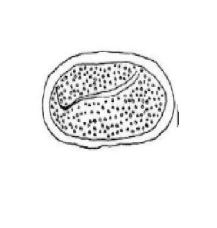 <p><em>Physaloptera</em></p>