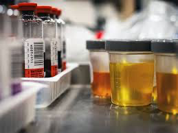 <p>White blood cells (WBCs) are <strong><mark data-color="yellow">part of</mark></strong></p>