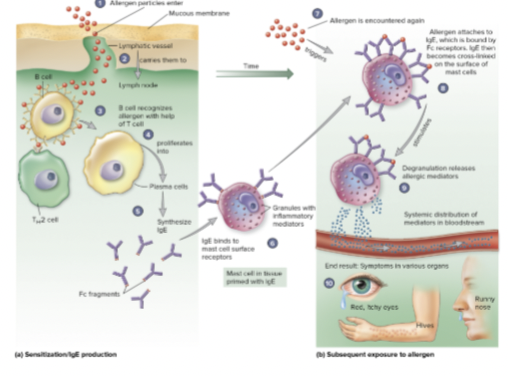 <p><span><span>Type 1 Hypersensitivity overview</span></span></p>