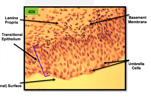 * lamia propria
* transitional epithelium