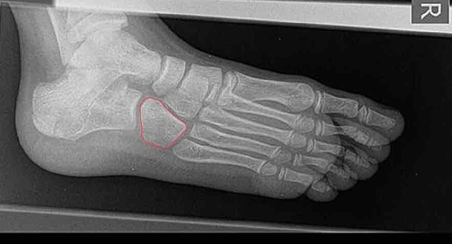 <p>What is this bone?</p>