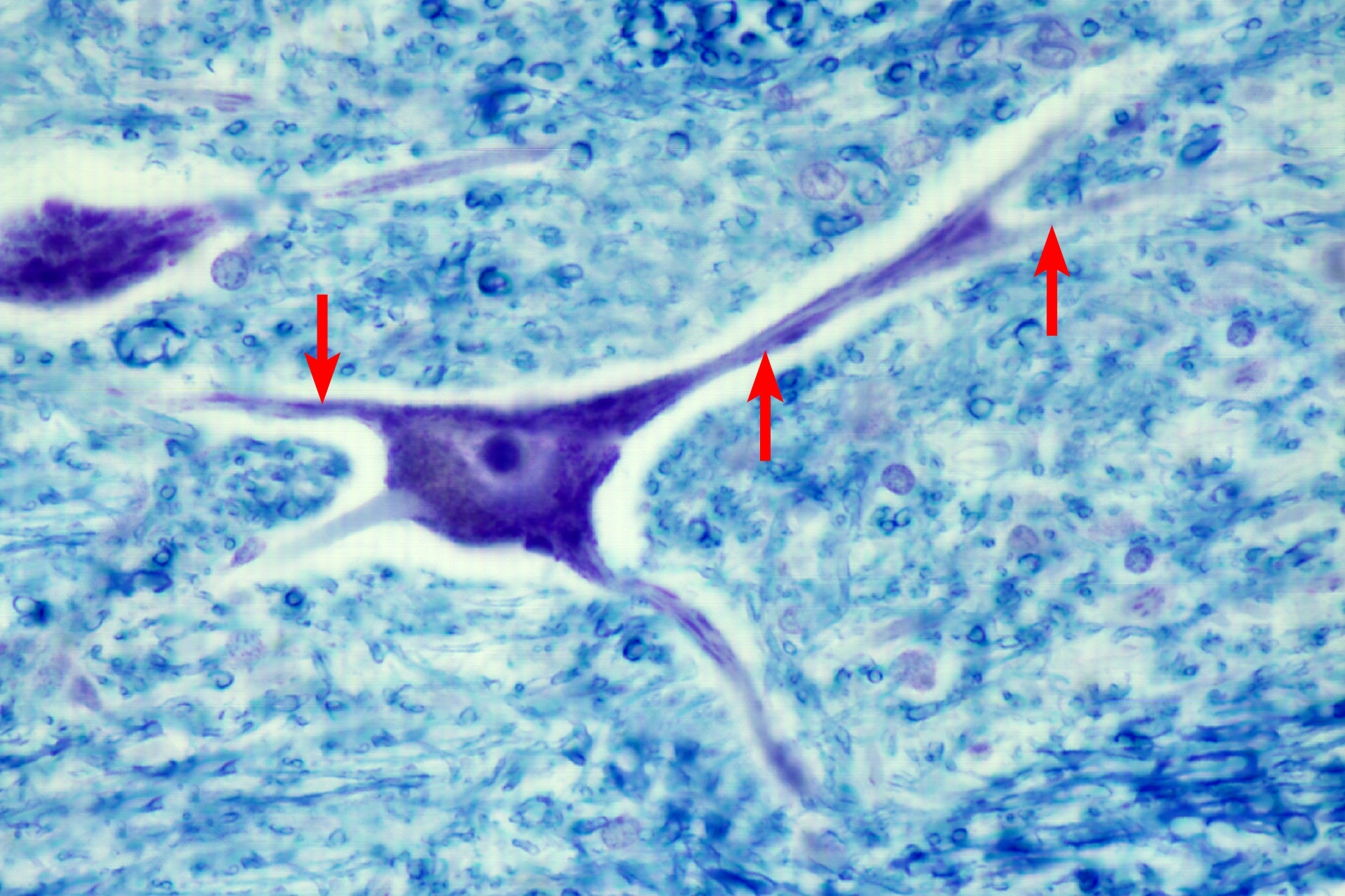 <p>What is pointed to in this image?</p>